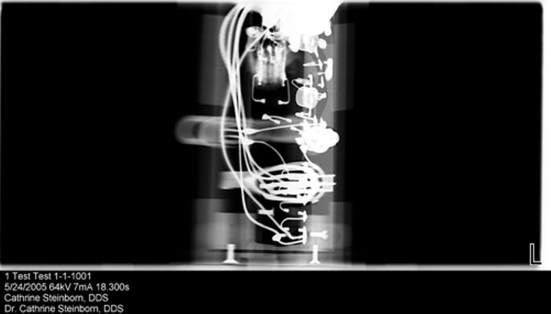 X-ray image of high-voltage power supply for light pen from DEC PDP-1