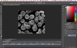 Photoshop scale bar (detail of red blood cells)